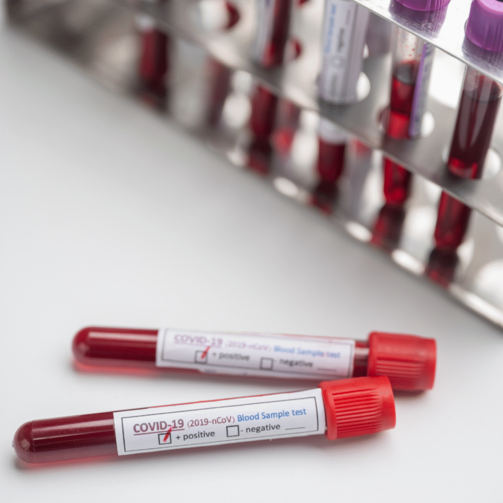 Pennsylvania Court Says Insurer Has No Duty to Defend Lab in COVID-19 Test Dispute