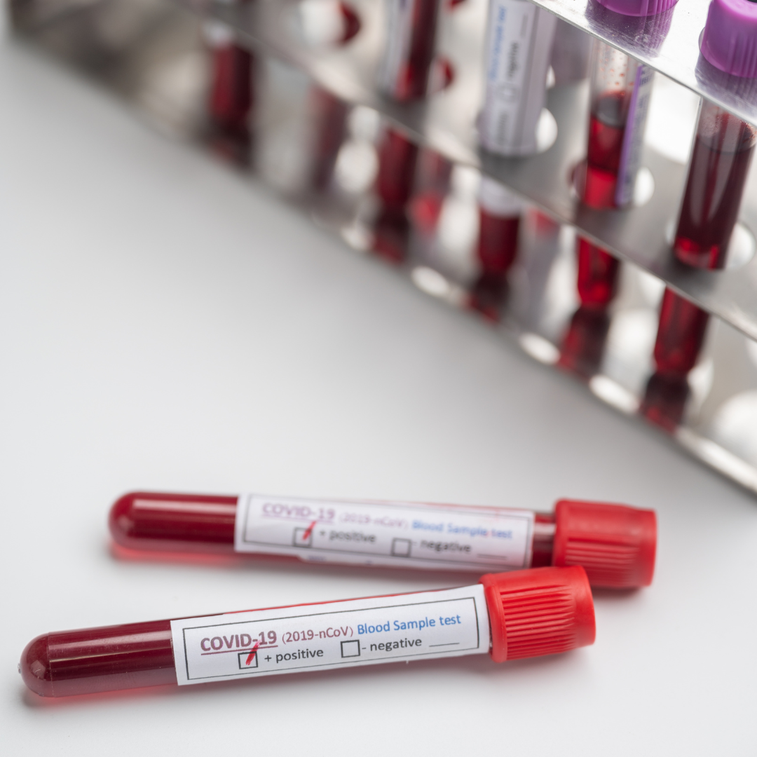Pennsylvania Court Says Insurer Has No Duty to Defend Lab in COVID-19 Test Dispute
